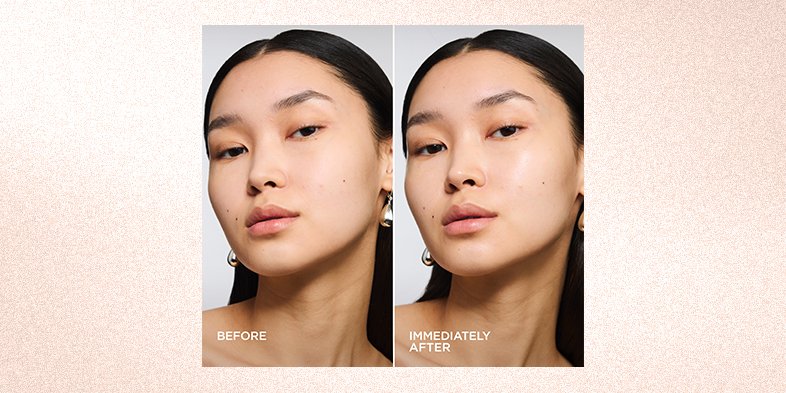 Before and after using product to reduce smile lines